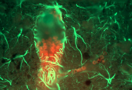 Astrocytes (green, GFAP) encircling an erythrocyte-filled (red) blood vessel in the dorsal hippocampus of a rat
