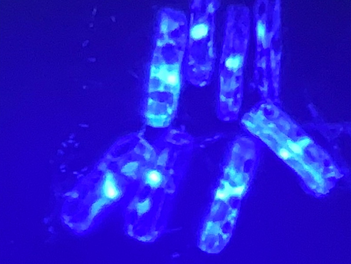 Close neighborhoods: biofilms Biofilm of benthic diatoms and bacteria stained with DAPI and visualized under a fluorescence microscope (600-fold magnification).