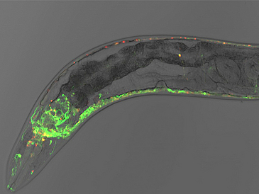 Mikroskopische Aufnahme eines Fadenwurms.