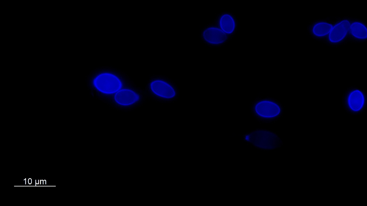 Hefepilze gefärbt mit Fluoreszenzfarbstoff. Die direkte Anfärbung der Pilze in der Umweltprobe ist von großer Bedeutung, da so Erkenntnisse über ihr morphologisches Erscheinungsbild, ihre Biomasse oder Interaktionspartner im Lebensraum gewonnen werden können.