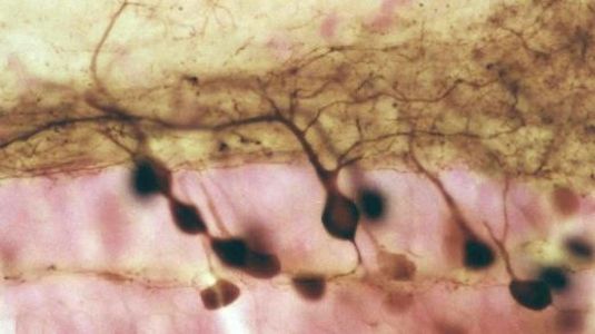 Mikroskopische Aufnahme Neurone